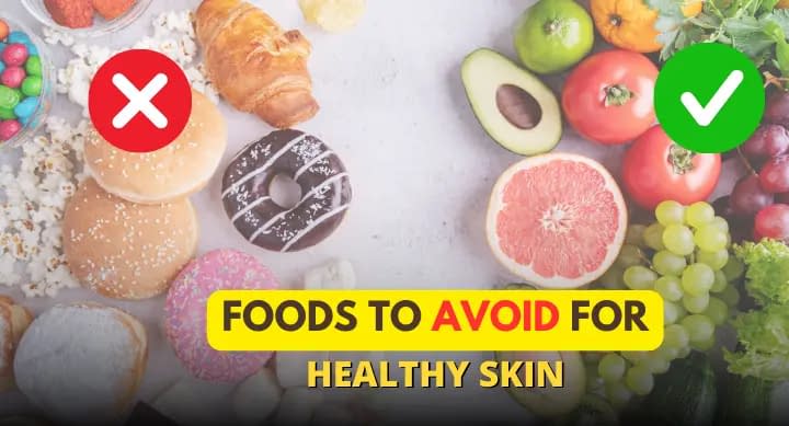 Foods to avoid for healthy skin