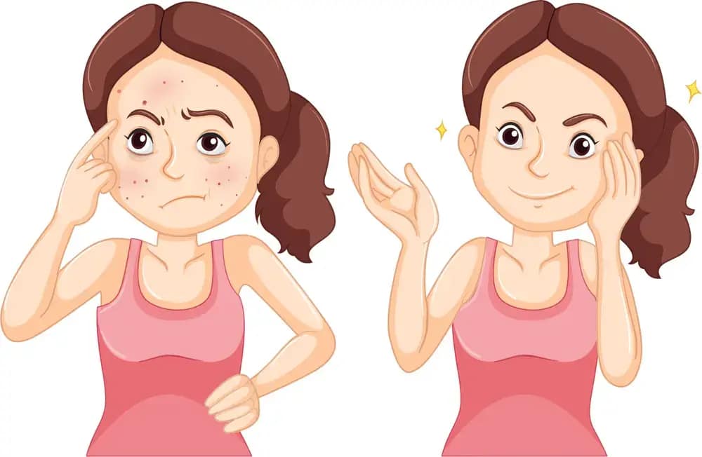 Importance of diet for skin health